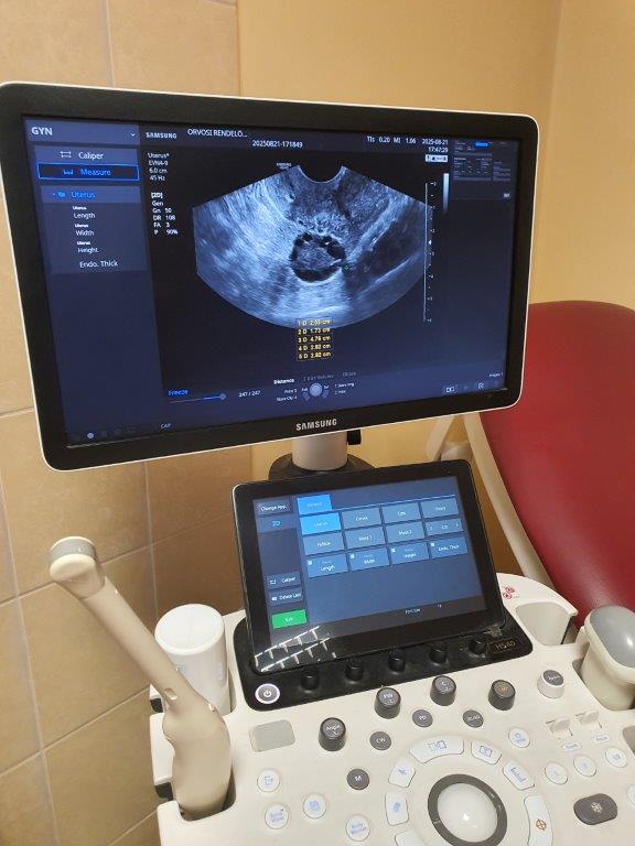 Használt Samsung Medison HS40 típusú ultrahang készülék nőgyógyászati vizsgálófejjel Használt Samsung Medison HS40 típusú ultrahang készülék nőgyógyászati vizsgálófejjel