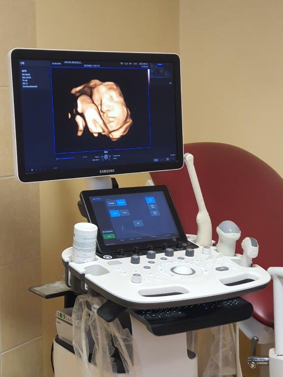 Használt Samsung Medison HS40 típusú ultrahang készülék 2D/3D/4D/5D hasi vizsgálófejjel Használt Samsung Medison HS40 típusú ultrahang készülék 2D/3D/4D/5D hasi vizsgálófejjel